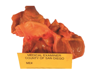 Heart specimen captured with Model 702 system